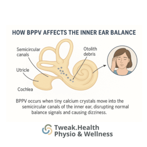 Hands-on physiotherapy for Vertigo or BPPV