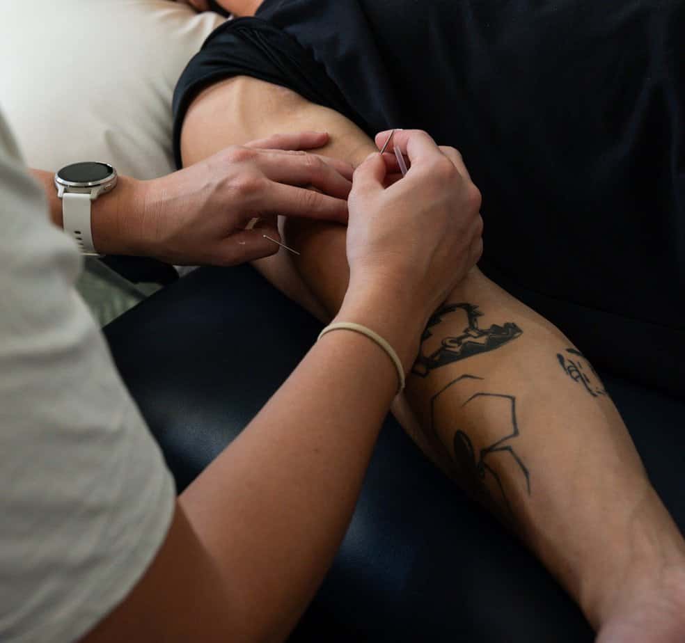 Physiotherapy Brentwood hands-on treatment near Mount Pleasant